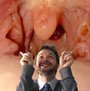 Tratamento de amigdalites em Curitiba | Cirurgia das amígdalas | Dr Lucas Zambon
